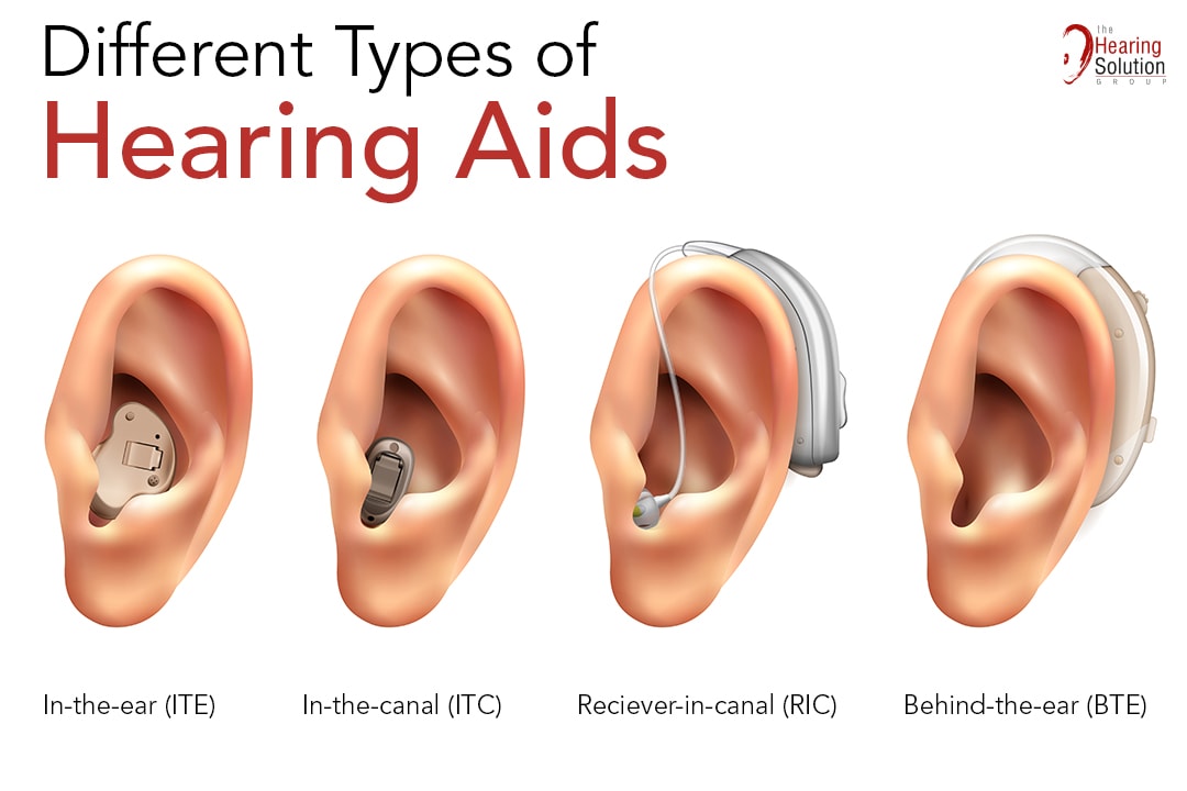 Deep Dive into the Different Types of Hearing Aids