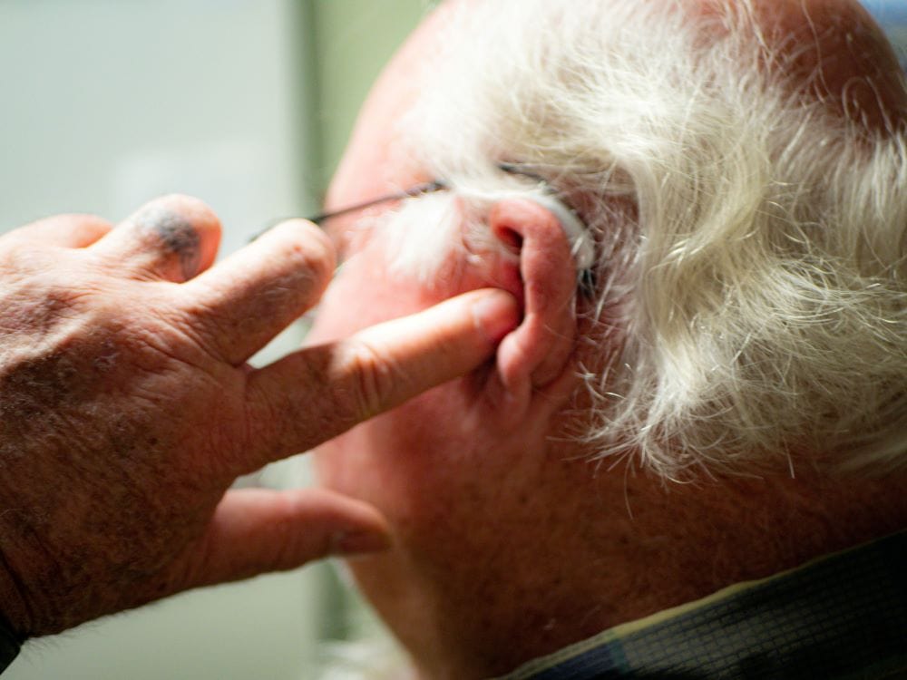 The 3 Types of Hearing Loss: Causes, Symptoms & Other Essential Info 1